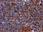 LIMK1 Antibody in Immunohistochemistry (Paraffin) (IHC (P))