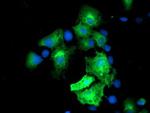 Monoacylglycerol Lipase Antibody in Immunocytochemistry (ICC/IF)