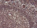 Monoacylglycerol Lipase Antibody in Immunohistochemistry (Paraffin) (IHC (P))