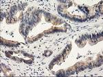 ILVBL Antibody in Immunohistochemistry (Paraffin) (IHC (P))