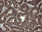 PBDC1 Antibody in Immunohistochemistry (Paraffin) (IHC (P))