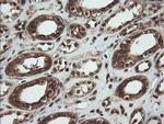 PBDC1 Antibody in Immunohistochemistry (Paraffin) (IHC (P))