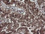 PBDC1 Antibody in Immunohistochemistry (Paraffin) (IHC (P))