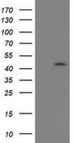 GDAP1L1 Antibody in Western Blot (WB)