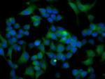 ATG3 Antibody in Immunocytochemistry (ICC/IF)