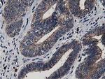 ATG3 Antibody in Immunohistochemistry (Paraffin) (IHC (P))