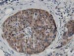 ATG3 Antibody in Immunohistochemistry (Paraffin) (IHC (P))