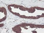 CNDP2 Antibody in Immunohistochemistry (Paraffin) (IHC (P))