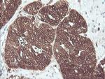 CNDP2 Antibody in Immunohistochemistry (Paraffin) (IHC (P))