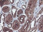 CNDP2 Antibody in Immunohistochemistry (Paraffin) (IHC (P))