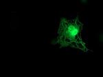 TMOD1 Antibody in Immunocytochemistry (ICC/IF)