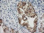 OSBP Antibody in Immunohistochemistry (Paraffin) (IHC (P))