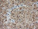 Aminoacylase Antibody in Immunohistochemistry (Paraffin) (IHC (P))