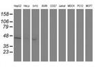 Aminoacylase Antibody in Western Blot (WB)