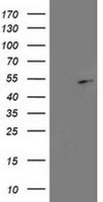 EBP1 Antibody in Western Blot (WB)