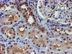 PSMD2 Antibody in Immunohistochemistry (Paraffin) (IHC (P))