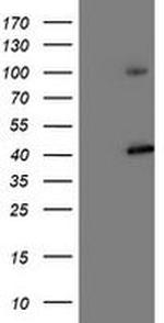 PSMD2 Antibody in Western Blot (WB)