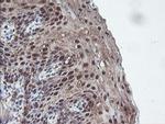 CBR3 Antibody in Immunohistochemistry (Paraffin) (IHC (P))