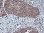 CBR3 Antibody in Immunohistochemistry (Paraffin) (IHC (P))