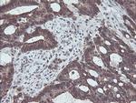 CBR3 Antibody in Immunohistochemistry (Paraffin) (IHC (P))