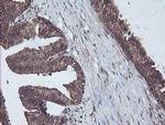 CBR3 Antibody in Immunohistochemistry (Paraffin) (IHC (P))