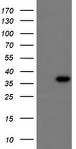 CBR3 Antibody in Western Blot (WB)