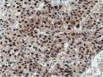 DPP3 Antibody in Immunohistochemistry (Paraffin) (IHC (P))