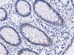 DPP3 Antibody in Immunohistochemistry (Paraffin) (IHC (P))