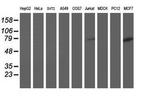 DPP3 Antibody in Western Blot (WB)