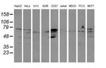 ALDH3A2 Antibody in Western Blot (WB)