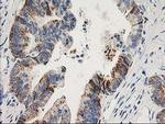 Adenylate Kinase 4 Antibody in Immunohistochemistry (Paraffin) (IHC (P))