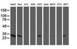 Adenylate Kinase 4 Antibody in Western Blot (WB)