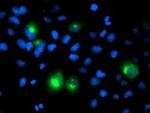 PTP1B Antibody in Immunocytochemistry (ICC/IF)