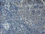 LGR5 Antibody in Immunohistochemistry (Paraffin) (IHC (P))