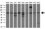 PDE1B Antibody in Western Blot (WB)