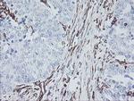 MCAK Antibody in Immunohistochemistry (Paraffin) (IHC (P))