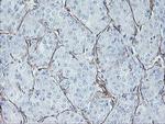 MCAK Antibody in Immunohistochemistry (Paraffin) (IHC (P))