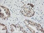 BAIAP2 Antibody in Immunohistochemistry (Paraffin) (IHC (P))