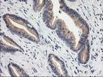 BAIAP2 Antibody in Immunohistochemistry (Paraffin) (IHC (P))