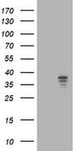 NUDT9 Antibody in Western Blot (WB)