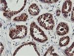 CoA Synthase Antibody in Immunohistochemistry (Paraffin) (IHC (P))