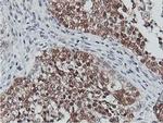 CoA Synthase Antibody in Immunohistochemistry (Paraffin) (IHC (P))