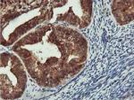 CoA Synthase Antibody in Immunohistochemistry (Paraffin) (IHC (P))