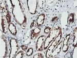 CoA Synthase Antibody in Immunohistochemistry (Paraffin) (IHC (P))