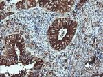 ATG3 Antibody in Immunohistochemistry (Paraffin) (IHC (P))