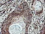 ATG3 Antibody in Immunohistochemistry (Paraffin) (IHC (P))