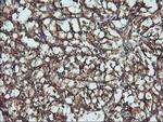 ATG3 Antibody in Immunohistochemistry (Paraffin) (IHC (P))