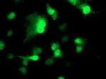 Nudel Antibody in Immunocytochemistry (ICC/IF)