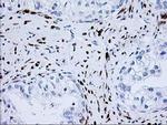 Nudel Antibody in Immunohistochemistry (Paraffin) (IHC (P))