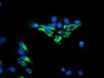 DLD Antibody in Immunocytochemistry (ICC/IF)